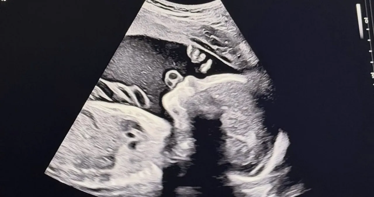 밴드 FT아일랜드 출신 송승현이 2세 소식을 전했다. 송승현 인스타그램 캡처