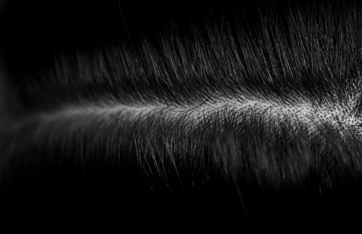 사진 : 두피 / unsplash.com