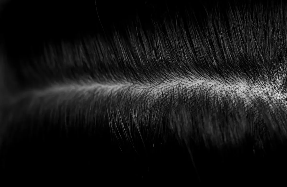사진 : 두피 / unsplash.com