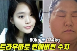 기사로 이동 - 미나♥류필립의 동생 수지 몸무게 144kg 고도비만 고백