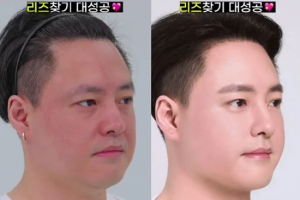 기사로 이동 - “비주얼 센터의 귀환”…NRG 노유민, 대머리 탈출 후 폭풍 비주얼 변신