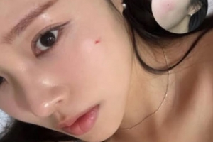 기사로 이동 - ‘박성광♥’ 이솔이, 예상치 못한 얼굴 부상...“닦아도 닦아도 피가”