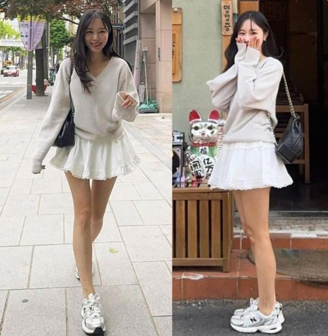 thumbnail - 이솔이, ‘암 투병’ 고백 후 미니스커트 입고 전한 근황…“지금은 지방 태우는 중”