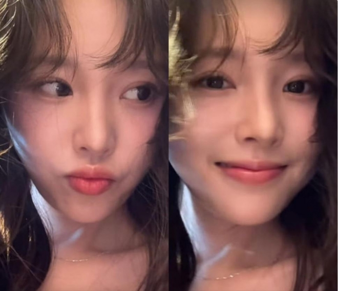 thumbnail - ‘암 고백’ 이솔이, 클로즈업에 더 빛나는 미모...“각자의 사정이 있구만”