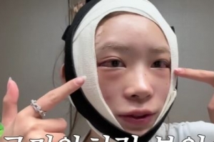 기사로 이동 - 최준희, 충격! 광대+눈 성형 과정 낱낱이 공개...“이번 수술은 좀 무서웠다”