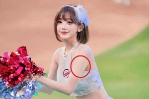 기사로 이동 - ‘대만서 눈물’ 치어리더 이주은, 상처투성이 몸에도 환한 미소…“응원은 멈출 수 없다”