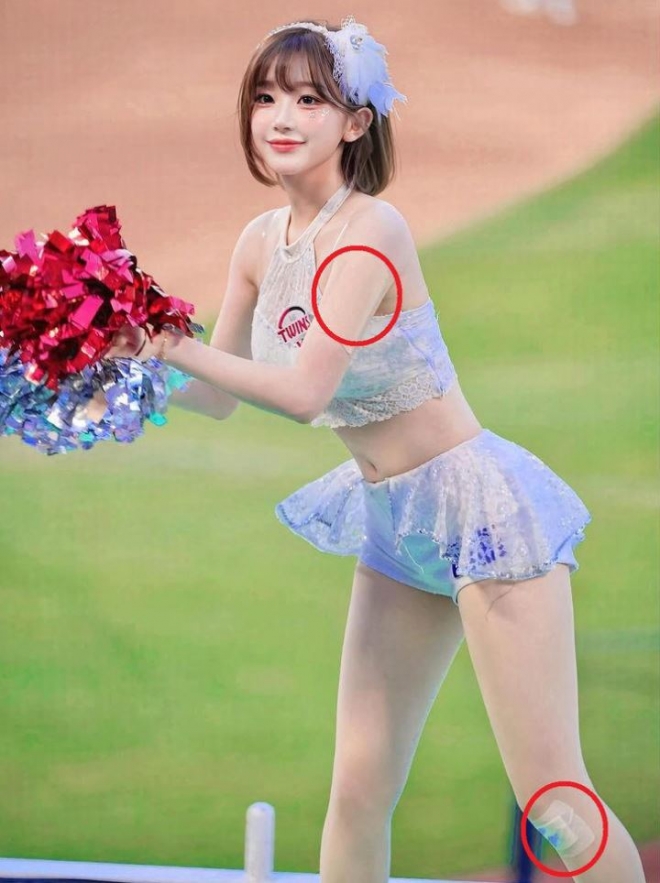 thumbnail - ‘대만서 눈물’ 치어리더 이주은, 상처투성이 몸에도 환한 미소…“응원은 멈출 수 없다”