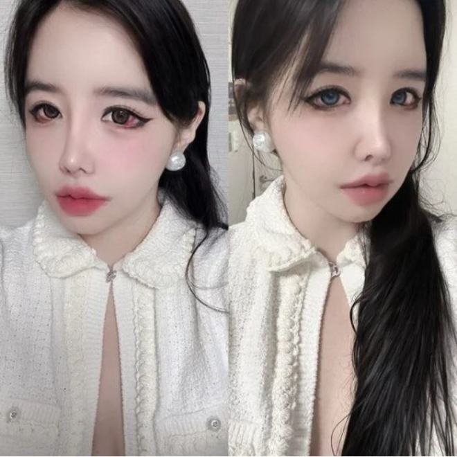 thumbnail - 2NE1 박봄, 건강 악화로 활동 중단…건강 이상설 사실이었나?