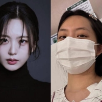 thumbnail - 걸그룹 ‘굿데이’ 출신 류지원, 백혈병 투병 고백
