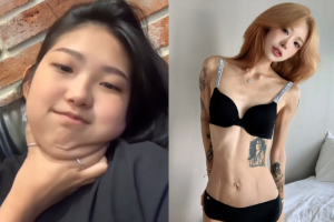 기사로 이동 - ‘96→41kg’ 최준희 “뼈말라 예뻐”…‘프로아나’ 건강 위험은?