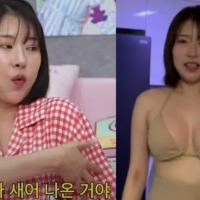 thumbnail - 이세영, “성형에 1억 원 썼다”…솔직 고백과 뒷이야기