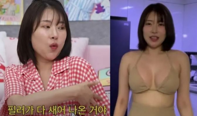 thumbnail - 이세영, “성형에 1억 원 썼다”…솔직 고백과 뒷이야기