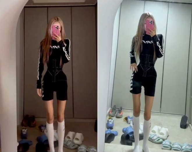 thumbnail - 최준희, 체중 증가로 생긴 튼살과 림프액 흘렀던 고통의 사진 공개...“다이어트가 날 살려