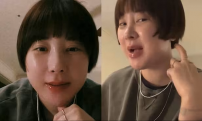 thumbnail - 서인영, 10kg 폭풍 증가→코 보형물 제거 “이게 진짜 내 모습”
