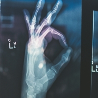 thumbnail - 폐경기, 뼈 건강에 ‘직격탄’… 골다공증 막는 ‘7가지 핵심 영양소’