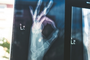 기사로 이동 - 폐경기, 뼈 건강에 ‘직격탄’… 골다공증 막는 ‘7가지 핵심 영양소’