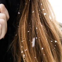 thumbnail - 겨울철 두피 건조증, 왜 심해질까…전문의가 알려주는 ‘실전 관리법’