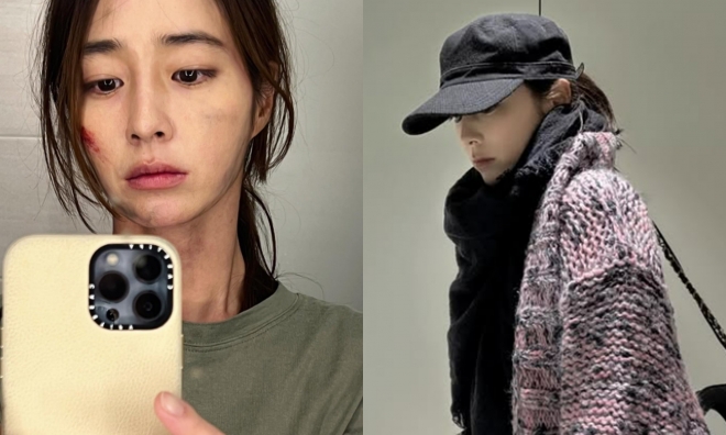 thumbnail - “이병헌도 깜짝 놀랐다”… 이민정, 피투성이로 올린 ‘이 사진’의 정체