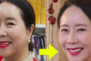 기사로 이동 - “이렇게 살 순 없다”… 63세 아나운서, 확 달라진 충격 근황