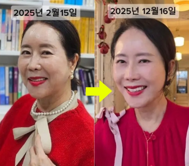 thumbnail - “이렇게 살 순 없다”… 63세 아나운서, 확 달라진 충격 근황