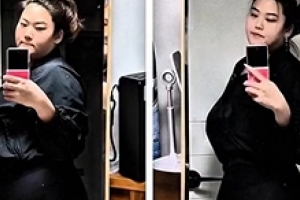 기사로 이동 - 턱살이 사라졌어요… 148kg→79kg, 요요 극복한 ‘이 사람’ 놀라운 근황