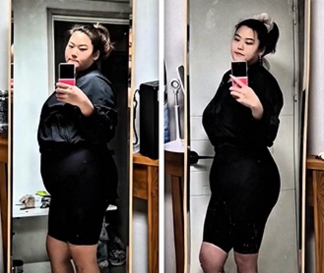 thumbnail - 턱살이 사라졌어요… 148kg→79kg, 요요 극복한 ‘이 사람’ 놀라운 근황