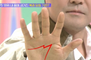 기사로 이동 - “연 40억 수입 그냥 아니네”… 전현무, 손바닥에 선명한 ‘이것’