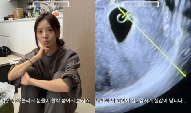 thumbnail - 눈물 왈칵 쏟아졌다… ‘하트시그널’ 그녀, 임신 초기 아찔한 사고