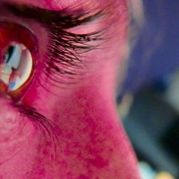 thumbnail - “결막염 인건가요?”...눈이 ‘빨갛고 끈적’해졌을 때 바로 확인해야 할 ‘이 것’