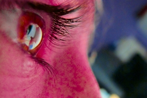 기사로 이동 - “결막염 인건가요?”...눈이 ‘빨갛고 끈적’해졌을 때 바로 확인해야 할 ‘이 것’