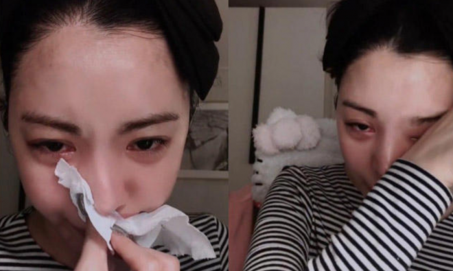 thumbnail - “살기 너무 힘들다”…리지, 인스타 라이브서 우울감 고백한 이유