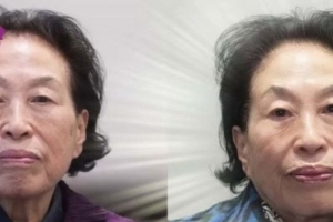 기사로 이동 - “완전 동생 됐네”… 500만원에 20년 젊어진 ‘국민 배우’의 충격 근황