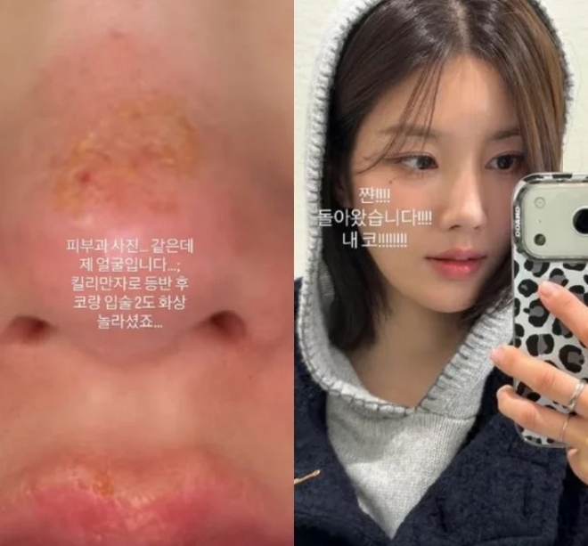 thumbnail - “얼굴이 새까맣게 탔다”… 킬리만자로 오른 ‘인기 여가수’ 충격 근황