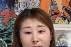 기사로 이동 - ‘들창코 성괴’ DM 한 통에… 15년 만에 코 재수술 택한 ‘서준맘’ 근황