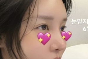 기사로 이동 - “좀 더 착해진 것 같기도”… 랄랄, 성형 6일 차 얼굴 공개