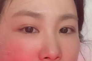 기사로 이동 - 원치않는 보조개가 생겼어요…김지민, 자녀계획 중 전해진 안타까운 근황