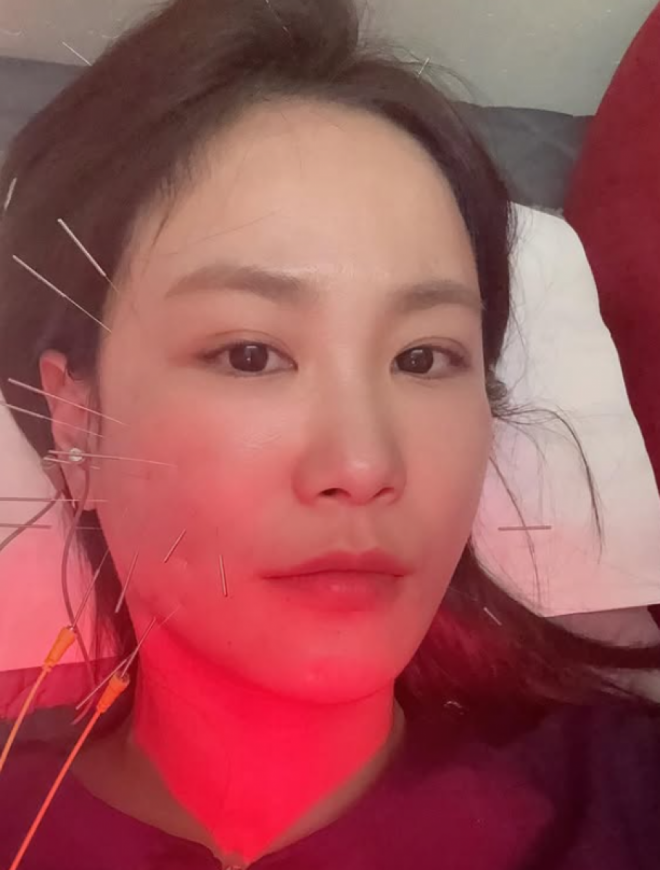 thumbnail - 원치않는 보조개가 생겼어요…김지민, 자녀계획 중 전해진 안타까운 근황