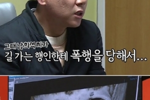 기사로 이동 - “코뼈가 휘면 인생이 꼬인다더니”… 이상민, 전치 8주 사건의 전말