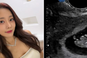 기사로 이동 - 따스한 4월에 찾아온 선물… 결혼 3년차 여배우의 기쁜 고백