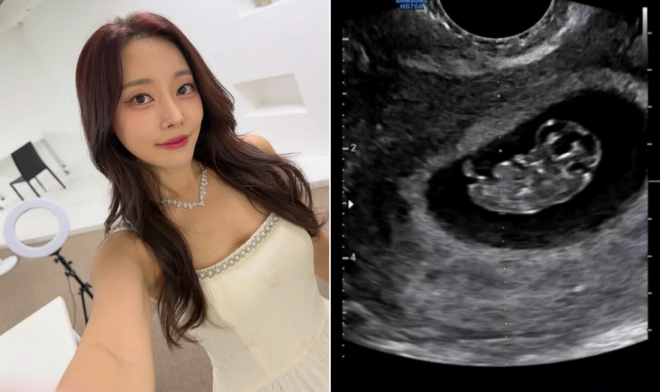 thumbnail - 따스한 4월에 찾아온 선물… 결혼 3년차 여배우의 기쁜 고백