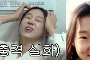 기사로 이동 - 오래 살고 싶어서 했는데… 이지혜, 인중 축소 후 듣게 된 한마디