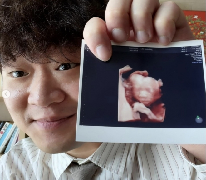 thumbnail - 봄바람처럼 찾아온 선물… ‘피식대학’ 정재형, 조심스러운 고백