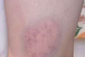 기사로 이동 - 아기돼지에게 손 내밀었다가 비명… ‘환승연애’ 그녀의 4월 태국 여행 악몽