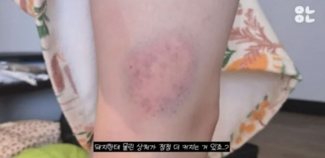 thumbnail - 아기돼지에게 손 내밀었다가 비명… ‘환승연애’ 그녀의 4월 태국 여행 악몽