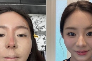 기사로 이동 - “거울 보고 깜짝 놀랐어요”… 38세 유이, 상하이서 도전한 ‘이 화장법’