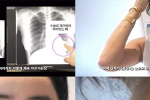 기사로 이동 - “온몸이 흉터”…폐암 극복한 이혜영, 5년 만에 전한 놀라운 근황