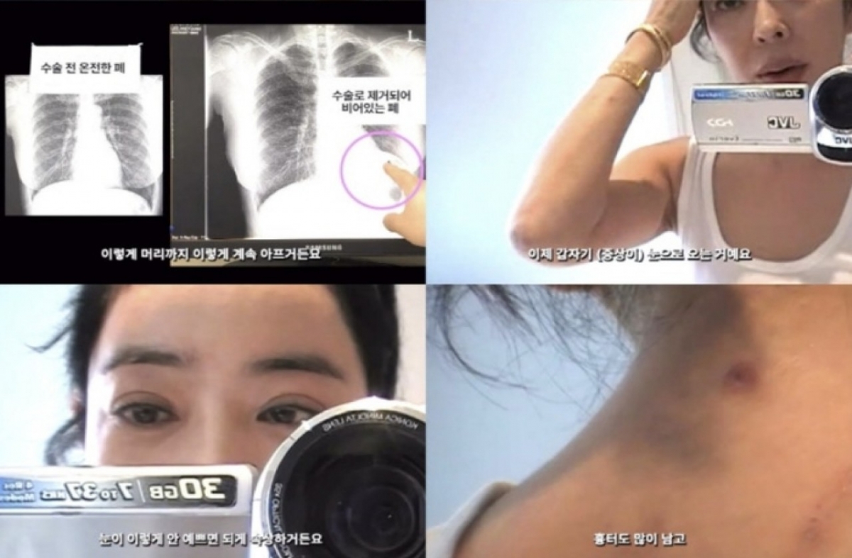 thumbnail - “온몸이 흉터”…폐암 극복한 이혜영, 5년 만에 전한 놀라운 근황