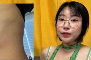 기사로 이동 - “가슴 4개 되고 갈비뼈까지…” 이세영이 공개한 필러 부작용