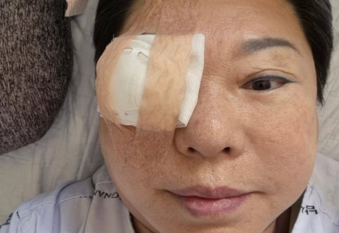 thumbnail - “나는 아파야만 쉬는 여자”…양희은, 각막이식 후 전한 근황