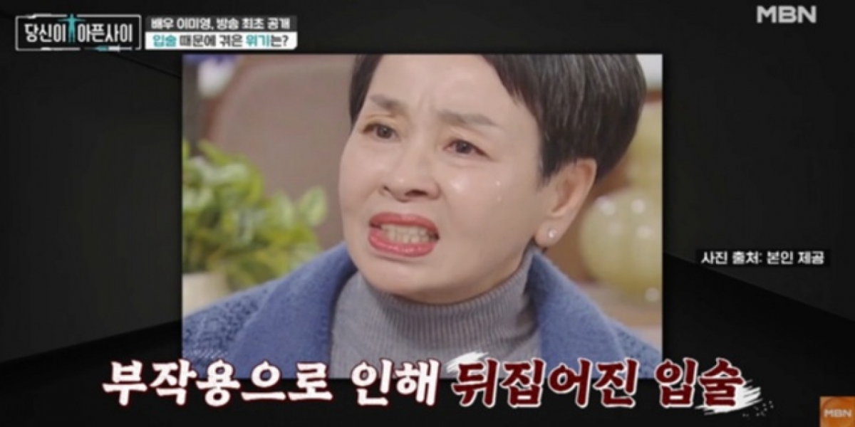 thumbnail - 공업용 실리콘 주사 두 방의 대가…일 끊기고 사극 퇴짜 맞은 여배우